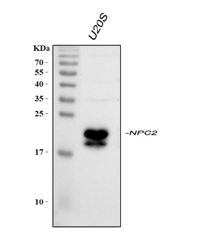 Niemann Pick C2/NPC2 Antibody