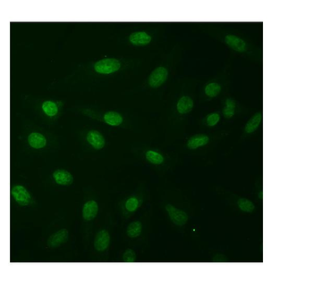 Natriuretic Peptide Receptor A/GC-A/NPR1 Picoband®/GC Rabbit Polyclonal Antibody