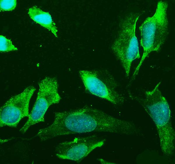 PLD2 Rabbit Polyclonal Antibody