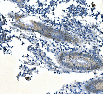 PPM1A Rabbit Polyclonal Antibody