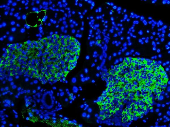Synaptophysin/SYP Antibody