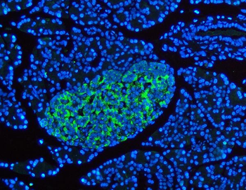 Synaptophysin/SYP Antibody
