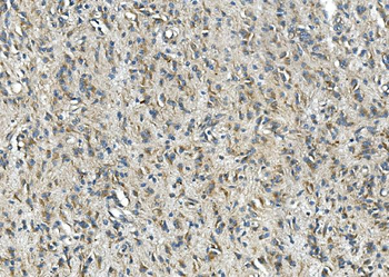 Synaptophysin/SYP Antibody