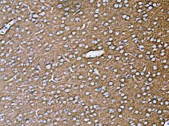 Synaptophysin/SYP Antibody