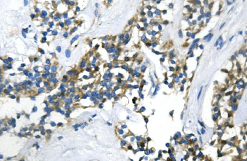 UBR2 Antibody