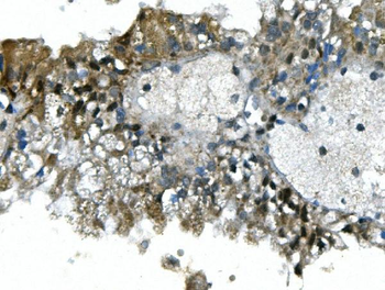 UBR2 Antibody