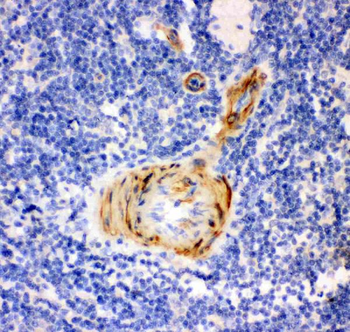 Gelsolin/GSN Rabbit Polyclonal Antibody