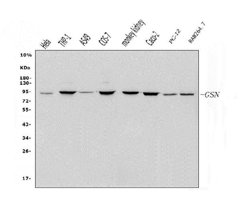 Gelsolin/GSN Rabbit Polyclonal Antibody