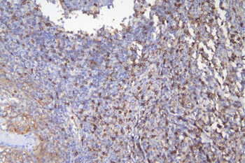 CD5 Mouse Monoclonal Antibody
