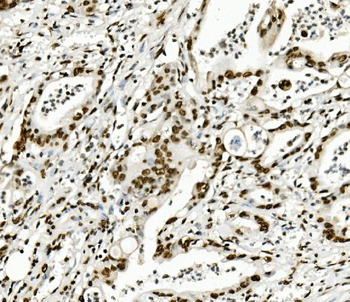 KAP1/TRIM28 Antibody (monoclonal, 3H2)