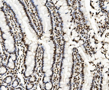 KAP1/TRIM28 Antibody (monoclonal, 3H2)