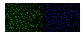 DDX5 Mouse Monoclonal Antibody