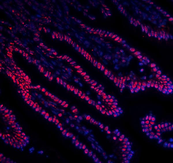 DDX5 Mouse Monoclonal Antibody