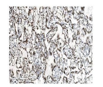 DDX5 Mouse Monoclonal Antibody