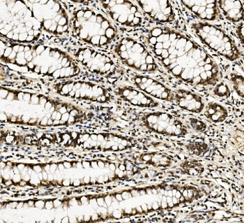 DDX5 Mouse Monoclonal Antibody