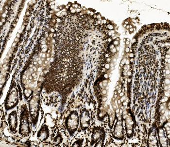 DDX5 Mouse Monoclonal Antibody