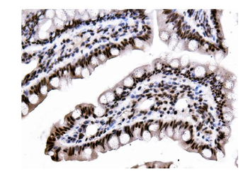 DDX5 Mouse Monoclonal Antibody