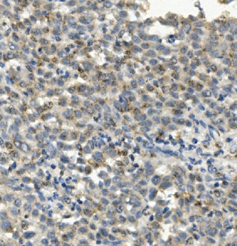 CCR2 Antibody (monoclonal, 8C4)