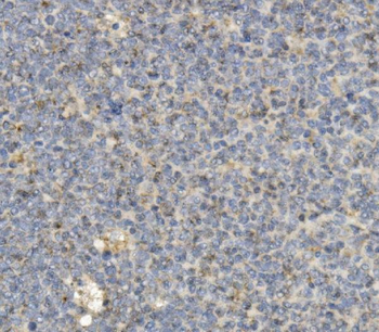 CCR2 Antibody (monoclonal, 8C4)