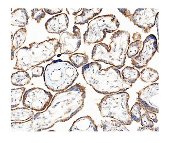 Hexokinase 1/HK1 Mouse Monoclonal Antibody