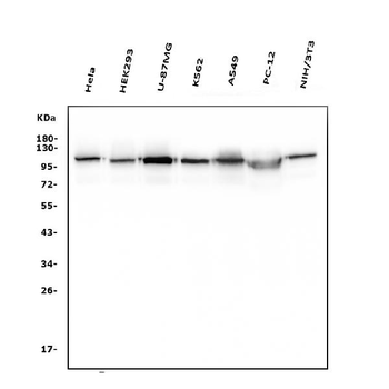 Hexokinase 1/HK1 Mouse Monoclonal Antibody