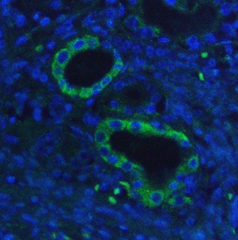 Hexokinase 1/HK1 Mouse Monoclonal Antibody