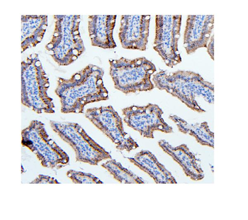 Hexokinase 1/HK1 Mouse Monoclonal Antibody