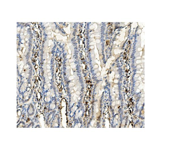 BubR1/BUB1B Antibody (monoclonal, 8B3)