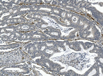 CD146/MCAM Mouse Monoclonal Antibody