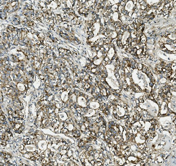 Thioredoxin 2/TXN2 Antibody (monoclonal, 7B5)