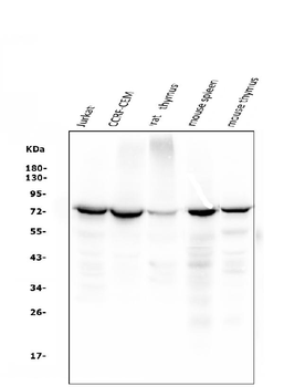 ZAP70 Mouse Monoclonal Antibody