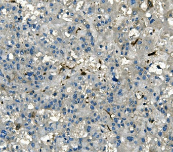 AKR1D1 Mouse Monoclonal Antibody