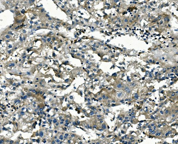 AKR1D1 Mouse Monoclonal Antibody