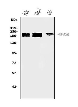 SMARCA2/BRM Antibody (monoclonal, 3G3)