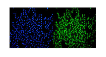 SMARCA2/BRM Antibody (monoclonal, 4E8)