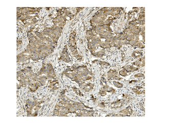 Methylmalonyl Coenzyme A mutase Mouse Monoclonal Antibody