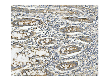 Methylmalonyl Coenzyme A mutase Mouse Monoclonal Antibody