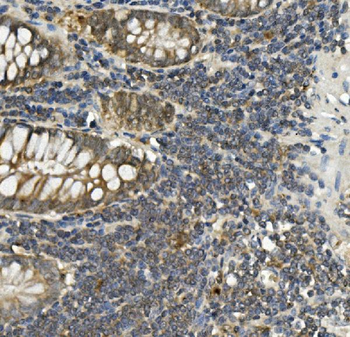 Bid Antibody (monoclonal, 10F4)