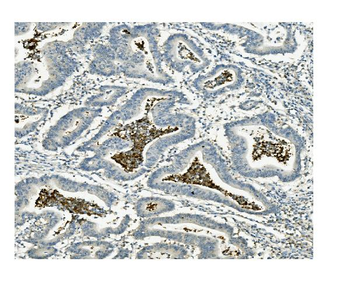 ATG4A Rabbit Polyclonal Antibody