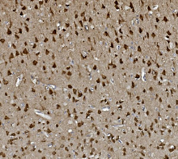 GAP43 Rabbit Polyclonal Antibody