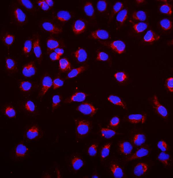 SGK1 Rabbit Polyclonal Antibody
