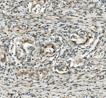 SGK1 Rabbit Polyclonal Antibody