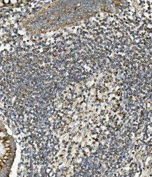 SGK1 Rabbit Polyclonal Antibody