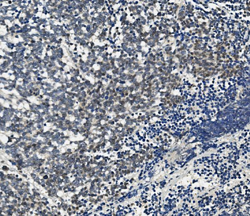 Aryl hydrocarbon Receptor/AHR Rabbit Polyclonal Antibody