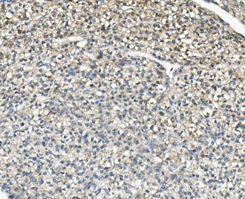 AKR1D1 Rabbit Polyclonal Antibody