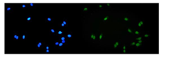 ALKBH1 Rabbit Polyclonal Antibody
