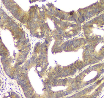 ALKBH1 Rabbit Polyclonal Antibody