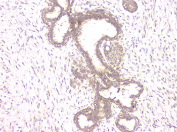 ALKBH1 Rabbit Polyclonal Antibody