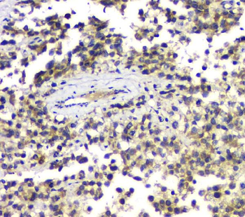 ALKBH1 Rabbit Polyclonal Antibody