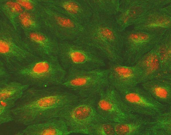 ALKBH5 Rabbit Polyclonal Antibody